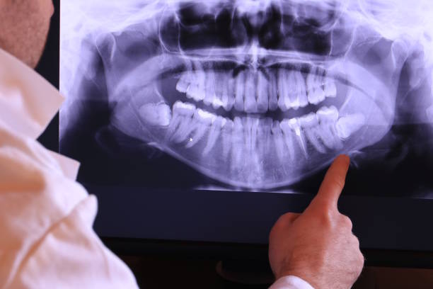 Best Emergency Dental Care for Abscessed Tooth in Bradley, WV