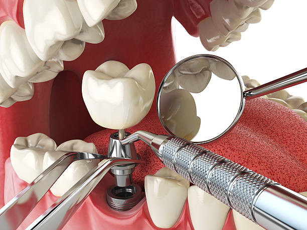 Best Emergency Dental Extractions in Bradley, WV